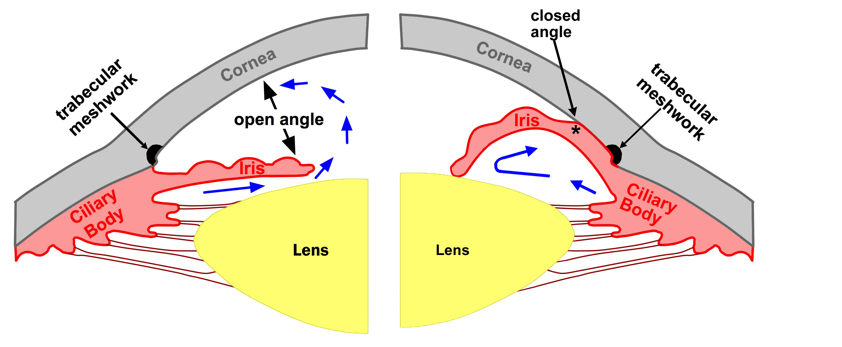 Ch 4 Types of Glaucoma. A Patient s Guide to Glaucoma